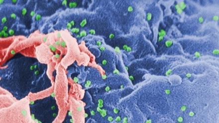 Humanizing HIV Surveillance? Assoc Prof Martin French
